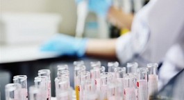 تاخیر دولت انگلیس در تایید آزمایشات پلاسما درمانی برای بیماران کووید-۱۹