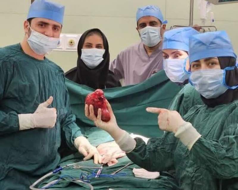 جراحی تومور ۱۴ سانتی از کلیه کودک ۲ ساله بندرعباسی