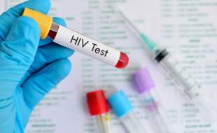 هفتمین بیمار مبتلا به HIV به طور کامل و قطعی درمان شد